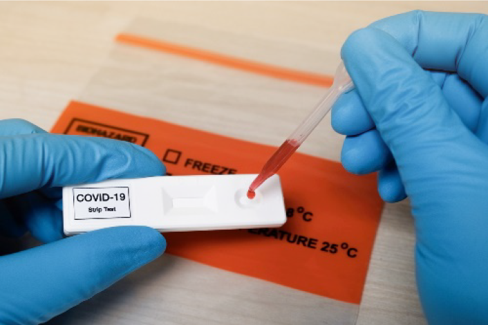 Gloved hands holding a point-of-care serology test. One hand is placing a drop of blood on a strip. The strip has the label “COVID-19”. 